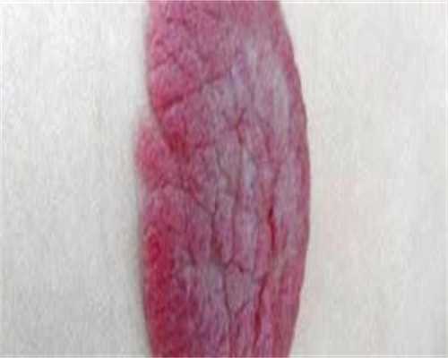 宜昌试管助孕费用详解