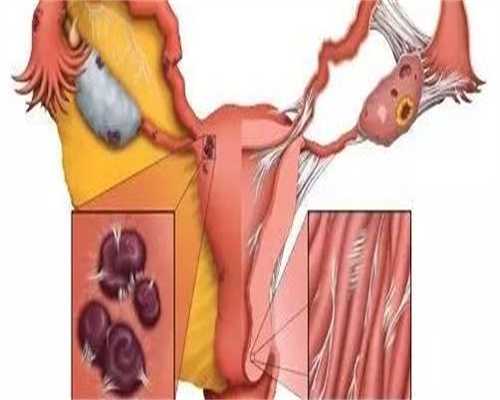 结扎后还能通过试管技术受孕吗