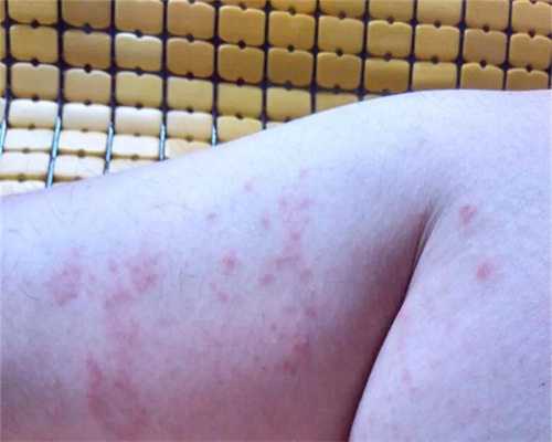 原发不孕三代试管费用解析及助孕方案选择