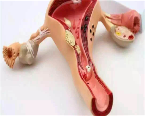 备孕期间子宫肌瘤对怀孕的影响及应对策略