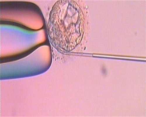三代试管婴儿医院费用解析及优化策略