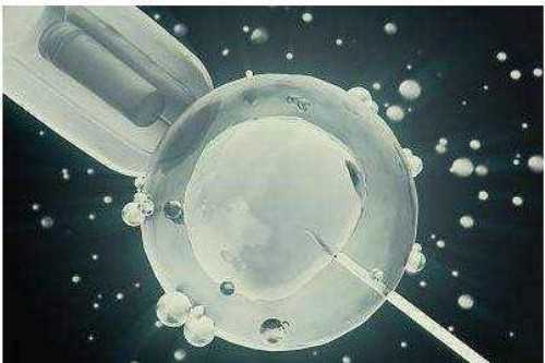 试管婴儿手术费用构成详解